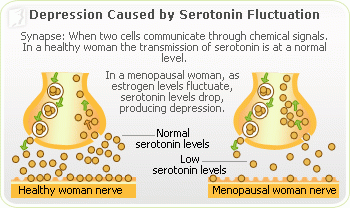 Depression-serotonin