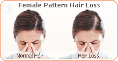 The causes of sudden hair loss in young women are personal and depend 