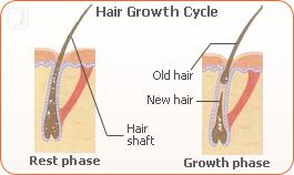 hair loss phase