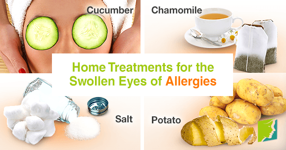 Home Treatments for the Swollen Eyes of Allergies1