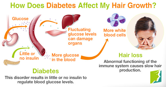 how-does-diabetes-affect-my-hair-growth.jpg