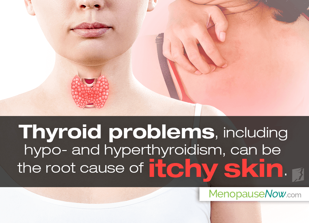 thyroid and itching