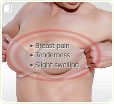 breast and tenderness pain severe